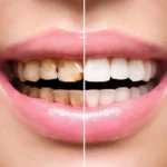 General And Cosmetic Dentistry